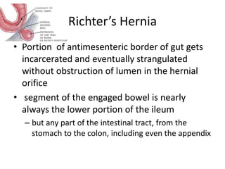 Etymology of hernia