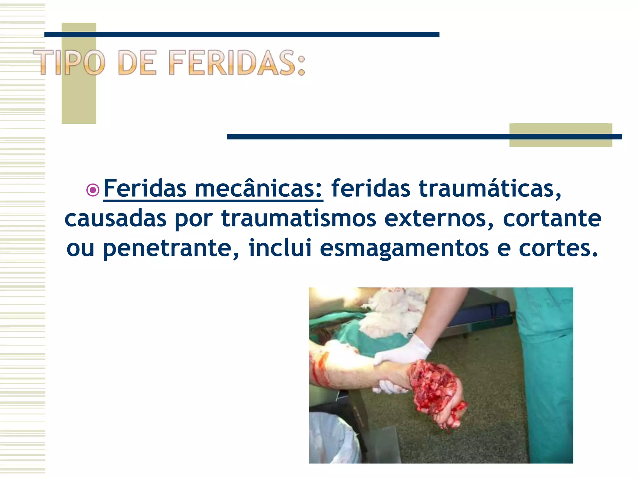 Feridas mecânicas: feridas traumáticas,
causadas por traumatismos externos, cortante
ou penetrante, inclui esmagamentos e cortes.
 