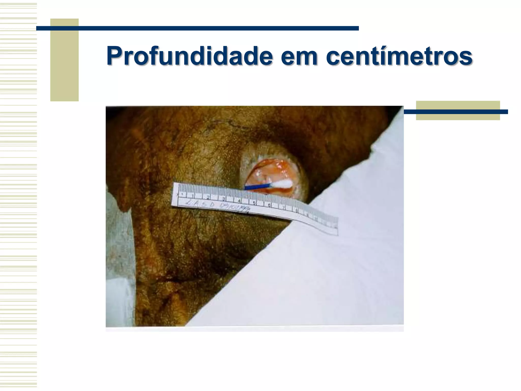 Profundidade em centímetros
 