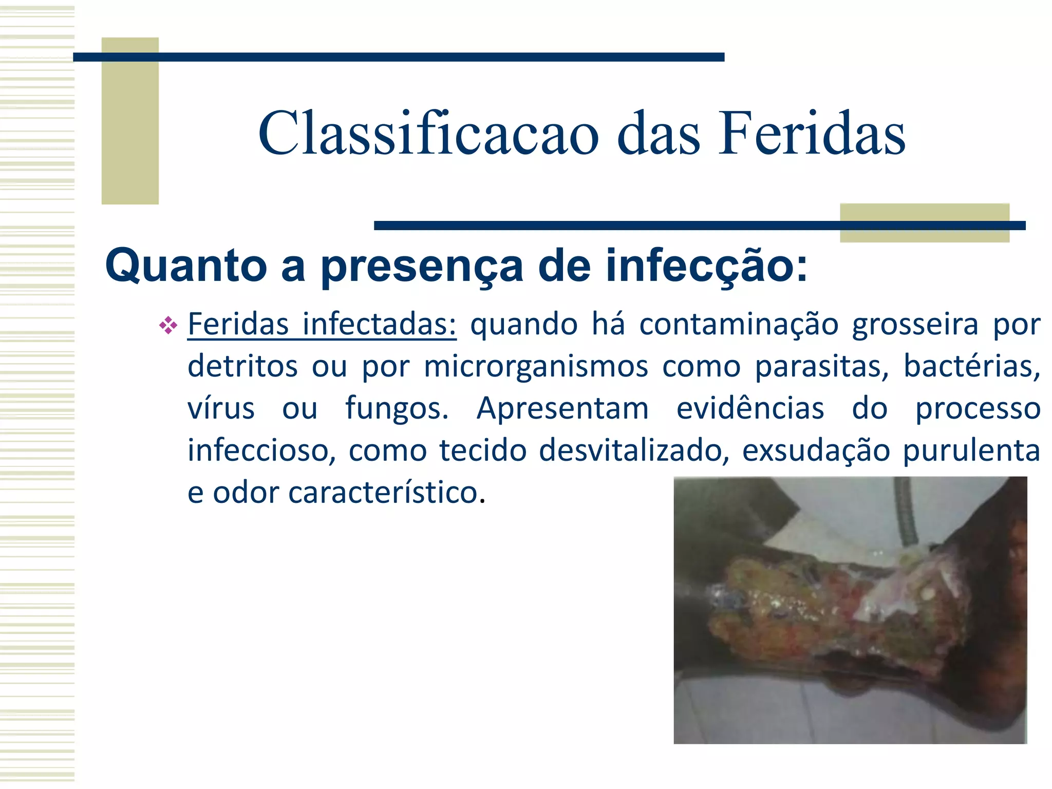 Quanto a presença de infecção:
 Feridas infectadas: quando há contaminação grosseira por
detritos ou por microrganismos como parasitas, bactérias,
vírus ou fungos. Apresentam evidências do processo
infeccioso, como tecido desvitalizado, exsudação purulenta
e odor característico.
Classificacao das Feridas
 