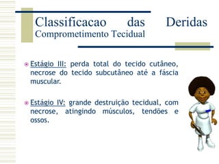  Estágio III: perda total do tecido cutâneo,
necrose do tecido subcutâneo até a fáscia
muscular.
 Estágio IV: grande destruição tecidual, com
necrose, atingindo músculos, tendões e
ossos.
Classificacao das Deridas
Comprometimento Tecidual
 