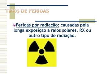 Feridas por radiação: causadas pela
longa exposição a raios solares, RX ou
outro tipo de radiação.
 