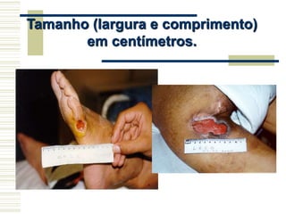 Tamanho (largura e comprimento)
em centímetros.
 