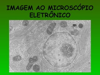 IMAGEM AO MICROSCÓPIO
ELETRÔNICO
 
