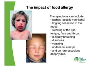 Diffuse Food Allergy Rash EU Food Regulations Food Allergen Labelling | PDF