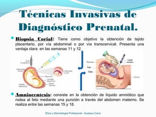 Técnicas Invasivas de
Diagnóstico Prenatal.
Biopsia Corial: Tiene como objetivo la obtención de tejido
placentario, por vía abdominal o por vía transcervical. Presenta una
ventaja clara en las semanas 11 y 12.
Amniocentesis: consiste en la obtención de líquido amniótico que
rodea al feto mediante una punción a través del abdomen materno. Se
realiza entre las semanas 15 y 18.
Ética y Deontología Profesional - Gustavo Cano
 
