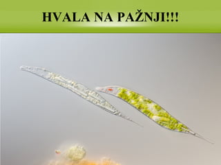 HVALA NA PAŽNJI!!!
 