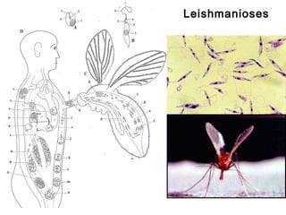 Leishmanioses
 