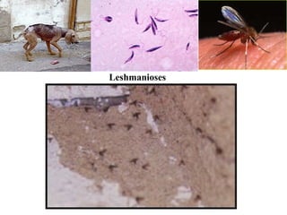 Leshmanioses
 