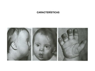 CARACTERÍSTICAS 