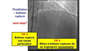 A brief review of complications and tips and tricks | PPTX