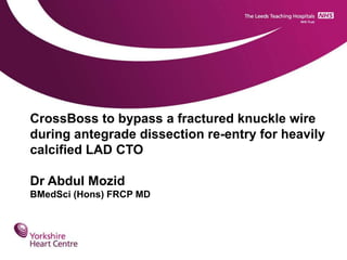 CrossBoss to bypass a fractured knuckle wire
during antegrade dissection re-entry for heavily
calcified LAD CTO
Dr Abdul Mozid
BMedSci (Hons) FRCP MD
 