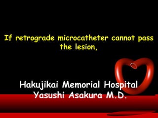 If retrograde microcatheter cannot pass
the lesion,
Hakujikai Memorial Hospital
Yasushi Asakura M.D.
 