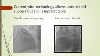Inpredictable Wires, what we need, what we have and next future | PPTX