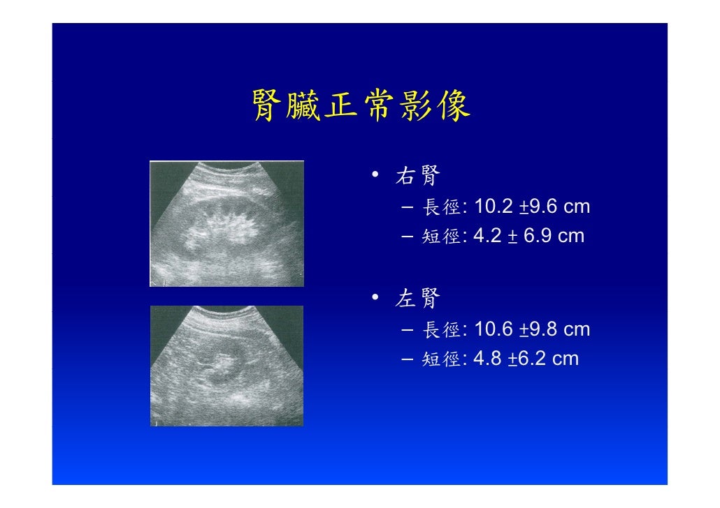 Eus教學 1 急診超音波之介紹 超音波基本認識