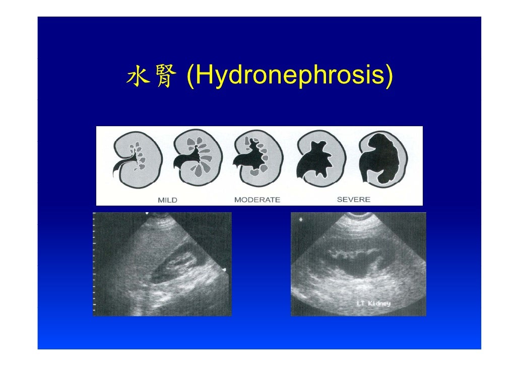 Eus教學 1 急診超音波之介紹 超音波基本認識