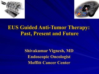 EUS Guided Anti-Tumor Therapy:  Past, Present and Future Shivakumar Vignesh, MD Endoscopic Oncologist Moffitt Cancer Center 