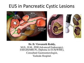 EUS in Pancreatic Cystic Lesions
Dr. D. Viswanath Reddy,
M.D., D.M., PDF(Advanced Endoscopy),
ESEGH(MRCP), Diploma in EUS(WISE),
Consultant Gastroenterologist,
Yashoda Hospital.
 