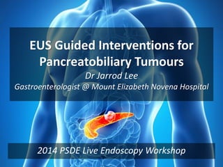EUS Guided Interventions for
Pancreatobiliary Tumours
Dr Jarrod Lee
Gastroenterologist @ Mount Elizabeth Novena Hospital
2014 PSDE Live Endoscopy Workshop
 