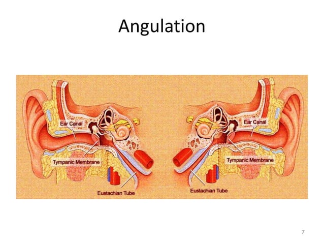 Eustachian tube anatomy test and disorders drvijaya sundarm 200317 Biology Diagrams