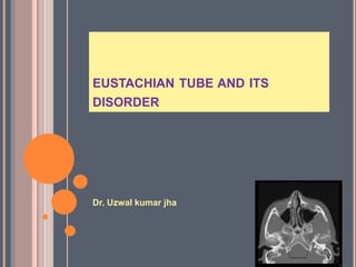 EUSTACHIAN TUBE AND ITS
DISORDER
Dr. Uzwal kumar jha
 