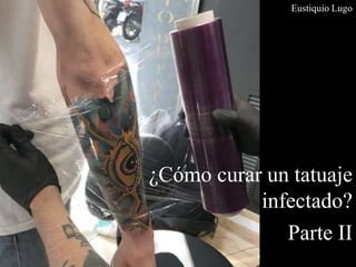 ¿Cómo curar un tatuaje
infectado?
Parte II
Eustiquio Lugo
 