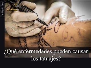 ¿Qué enfermedades pueden causar
los tatuajes?
EustiquioLugo
 
