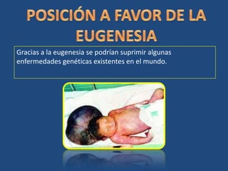 POSICIÓN A FAVOR DE LA EUGENESIAGracias a la eugenesia se podrían suprimir algunas enfermedades genéticas existentes en el mundo. 