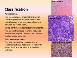 E uterus | PPTX