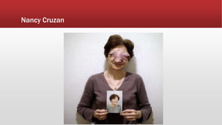 Nancy Cruzan
 