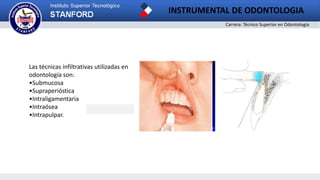 Carrera: Técnico Superior en Odontología
INSTRUMENTAL DE ODONTOLOGIA
2
Las técnicas infiltrativas utilizadas en
odontología son:
•Submucosa
•Supraperióstica
•Intraligamentaria
•Intraósea
•Intrapulpar.
 