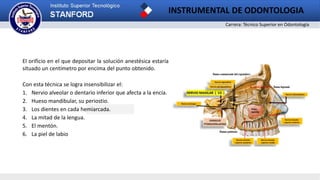 Carrera: Técnico Superior en Odontología
INSTRUMENTAL DE ODONTOLOGIA
2
El orificio en el que depositar la solución anestésica estaría
situado un centímetro por encima del punto obtenido.
Con esta técnica se logra insensibilizar el:
1. Nervio alveolar o dentario inferior que afecta a la encía.
2. Hueso mandibular, su periostio.
3. Los dientes en cada hemiarcada.
4. La mitad de la lengua.
5. El mentón.
6. La piel de labio
 