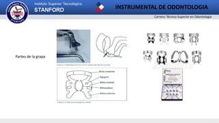 Carrera: Técnico Superior en Odontología
INSTRUMENTAL DE ODONTOLOGIA
Partes de la grapa
 