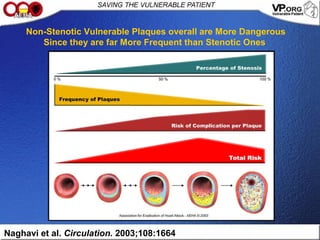 Naghavi et al. Circulation. 2003;108:1664
Non-Stenotic Vulnerable Plaques overall are More Dangerous
Since they are far More Frequent than Stenotic Ones
 