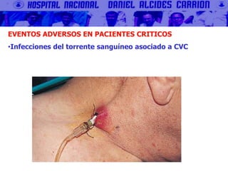 EVENTOS ADVERSOS EN PACIENTES CRITICOS
•Infecciones del torrente sanguíneo asociado a CVC
 
