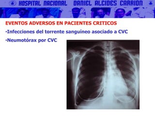 EVENTOS ADVERSOS EN PACIENTES CRITICOS
•Infecciones del torrente sanguíneo asociado a CVC
•Neumotórax por CVC
 