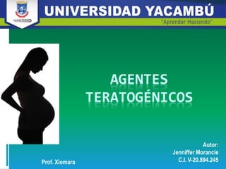 AGENTES
TERATOGÉNICOS
Prof. Xiomara
Autor:
Jenniffer Morancie
C.I. V-20.894.245
 