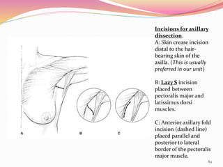 Evaluation and Management of Carcinoma Breast | PPTX