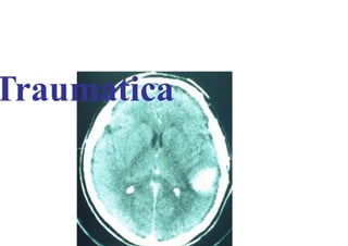 Traumatica
Traumatica
 