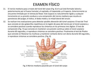 EXAMEN FÍSICO
11. El nervio mediano pasa a través del túnel del carpo (Fig. 6) el cual está formado lateral y
poteriorment...
