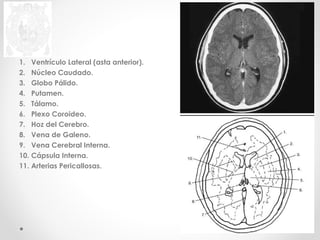 1. Ventrículo Lateral (asta anterior). 
2. Núcleo Caudado. 
3. Globo Pálido. 
4. Putamen. 
5. Tálamo. 
6. Plexo Coroideo. 
7. Hoz del Cerebro. 
8. Vena de Galeno. 
9. Vena Cerebral Interna. 
10. Cápsula Interna. 
11. Arterias Pericallosas. 
 