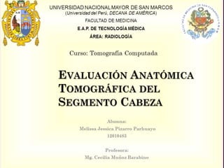 UNIVERSIDAD NACIONAL MAYOR DE SAN MARCOS 
(Universidad del Perú, DECANA DE AMÉRICA) 
FACULTAD DE MEDICINA 
E.A.P. DE TECNOLOGÍA MÉDICA 
ÁREA: RADIOLOGÍA 
Curso: Tomografía Computada 
Alumna: 
12010483 
 