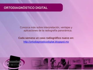 ORTODIAGNÓSTICO DIGITAL




        Conozca más sobre interpretación, ventajas y
          aplicaciones de la radiografía panorámica.

       Cada semana un caso radiográfico nuevo en:
          http://ortodiagnosticodigital.blogspot.mx
 