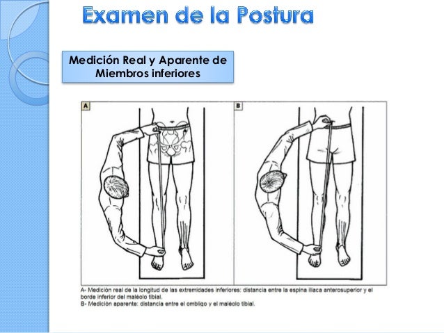 Medicion Real Y Aparente De Miembros Inferiores www.slideshare.net