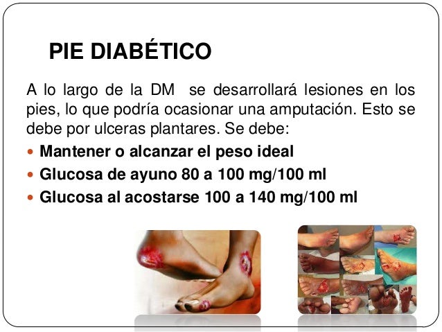 Edema nutricional