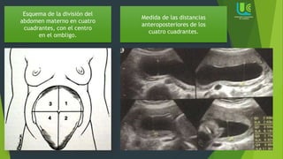 Esquema de la división del
abdomen materno en cuatro
cuadrantes, con el centro
en el ombligo.
Medida de las distancias
anteroposteriores de los
cuatro cuadrantes.
 