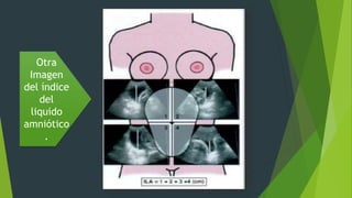 Otra
Imagen
del índice
del
liquido
amniótico
.
 