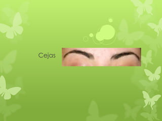 Cejas
 