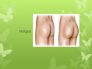 Nalgas
 