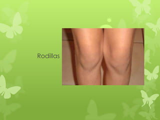 Rodillas
 